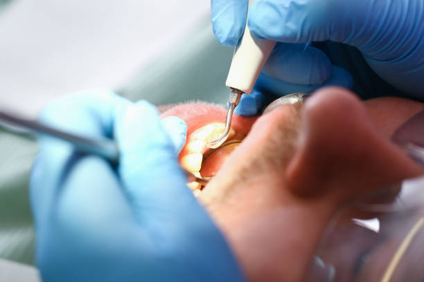 Best Emergency Care for Gum Disease in Gibraltar, MI